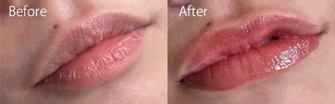 リップアートビフォーアフター